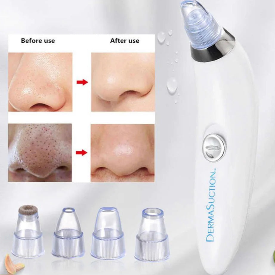 4-in-1 Skin Purifying Tool