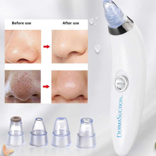 4-in-1 Skin Purifying Tool
